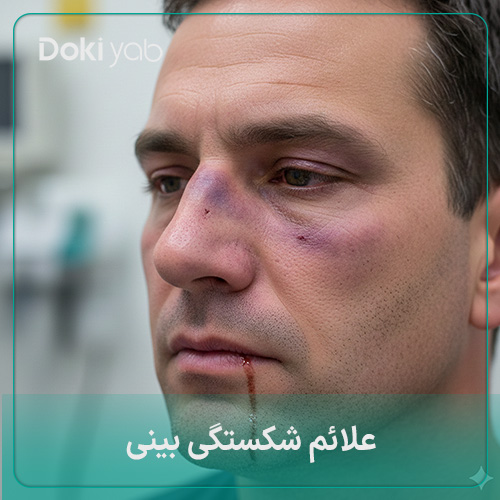 بررسی انواع علائم شکستگی بینی