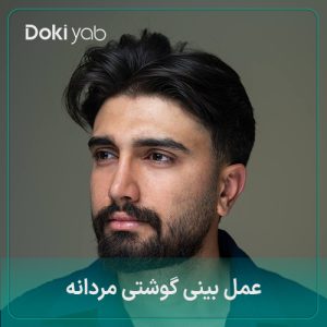 عمل بینی گوشتی مردانه