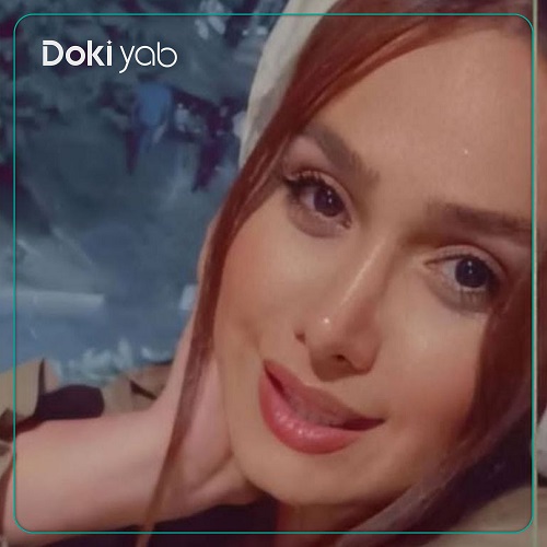 نمونه جراحی بینی زنانه دکتر مهشید خورده چی در اصفهان