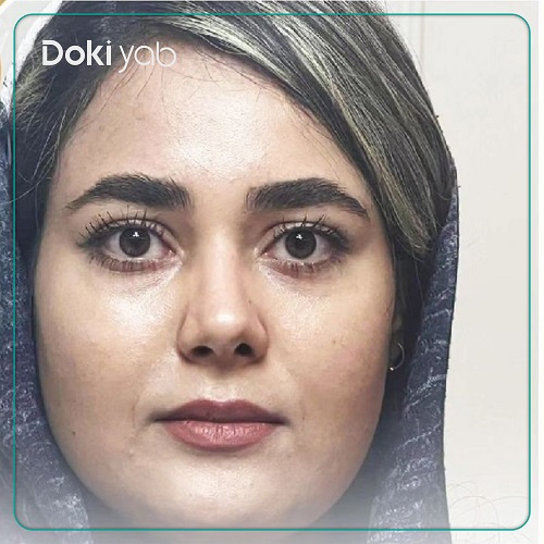 نمونه بینی نیمه فانتزی نوک گرد دکتر مجید راستی
