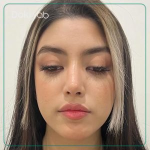 نمونه کار فانتزی دکتر پیام حق پناه