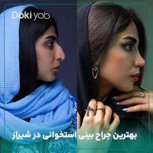 معرفی بهترین جراحان عمل بینی استخوانی در شیراز؛ دکی یاب
