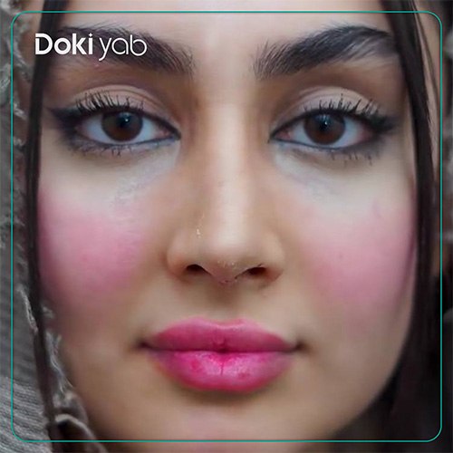نمونه کار عمل بینی دکتر ابراهیم حاتمی پور