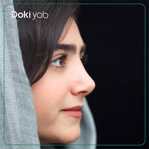 نمونه کار جراحی بینی به سبک نیمه فانتزی دکتر ابراهیم حاتمی پور