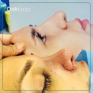 نمونه کار دکتر کاظم رشته احمدی جراح بینی در شیراز