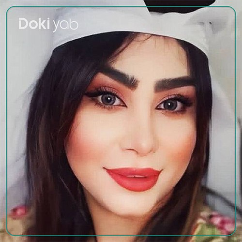 نمونه کار جراحی بینی به سبک نیمه فانتزی دکتر کاظم رشته احمدی جراح بینی در شیراز