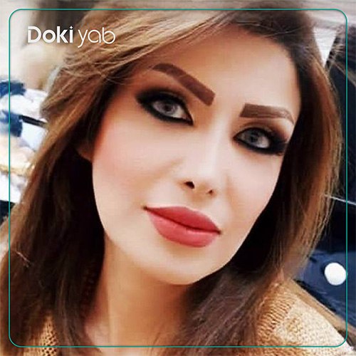نمونه کار جراحی بینی به سبک فانتزی دکتر کاظم رشته احمدی جراح بینی در شیراز