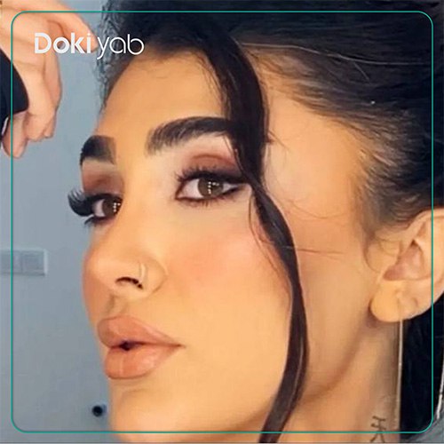 نمونه کار عمل بینی نیمه فانتزی توسط دکتر کاظم رشته احمدی جراح بینی در شیراز