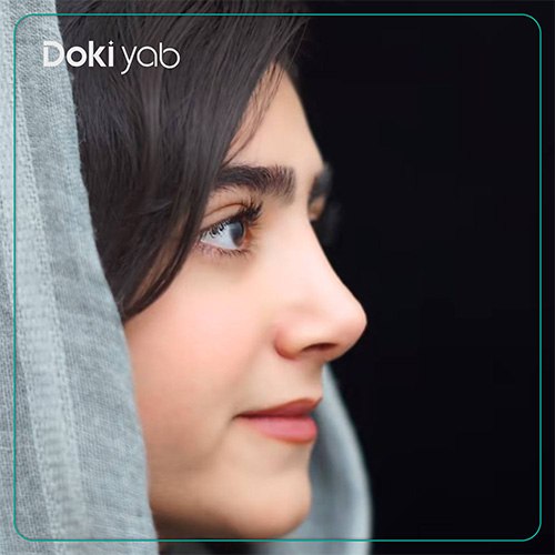نمونه کار جراحی بینی طبیعی دکتر مسعود جانی پور جراح بینی در شیراز