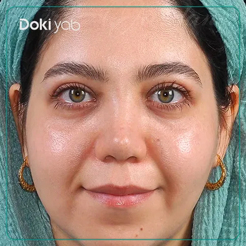 نمونه کار عمل بینی دکتر علی جاودانی