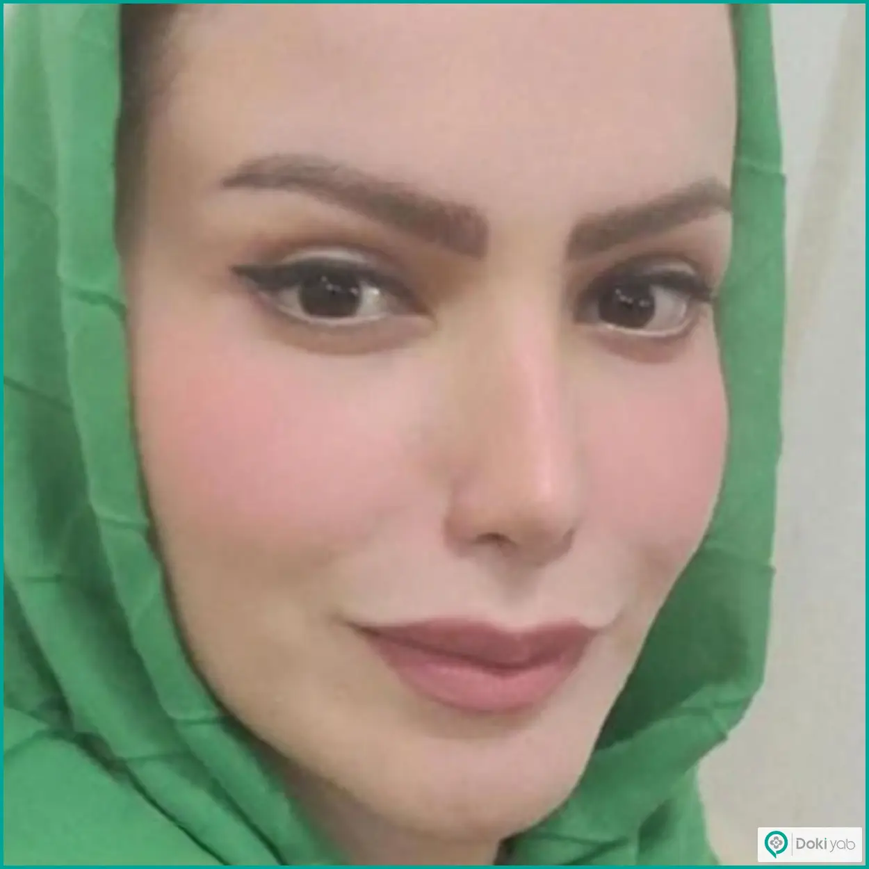 نمونه عمل بینی طبیعی دکتر بهروز گندمی جراح بینی شیراز