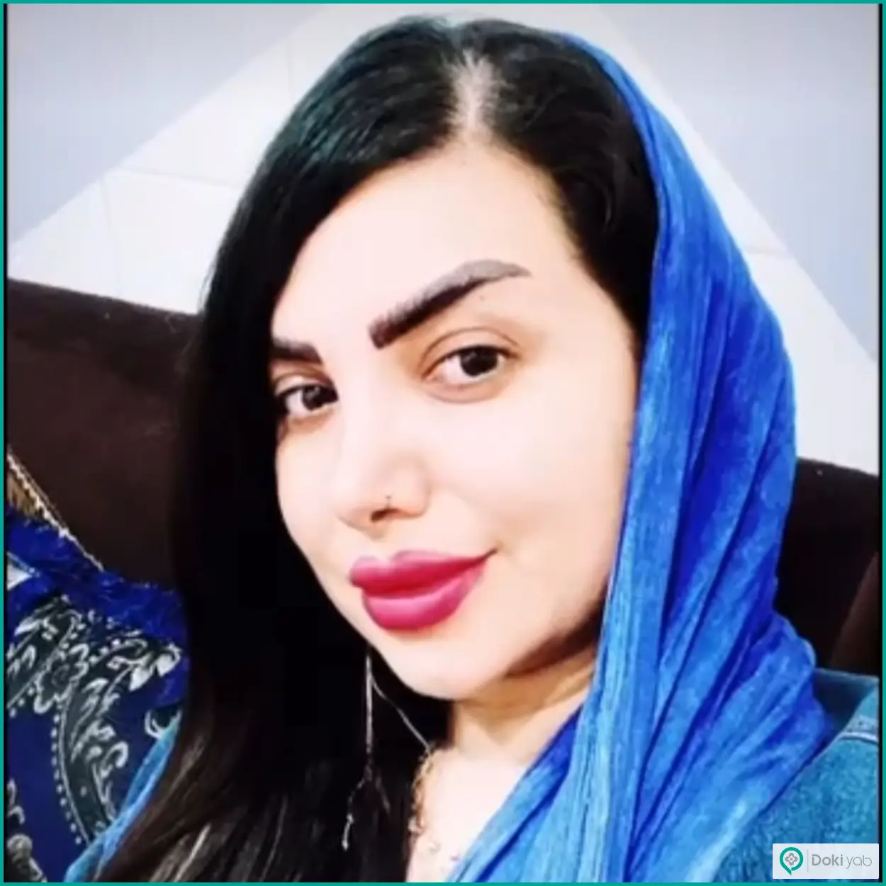نمونه کار عمل بینی نیمه فانتزی دکتر بهروز گندمی جراح بینی در شیراز