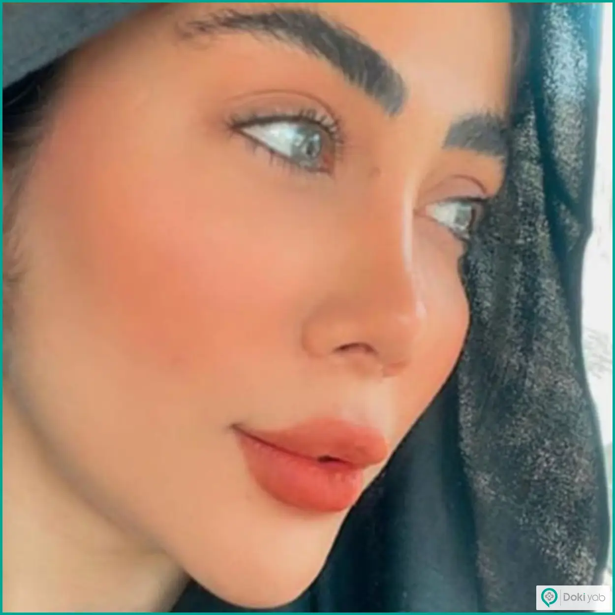 نمونه عمل زیبایی بینی نیمه فانتزی دکتر بهروز گندمی جراح بینی در شیراز
