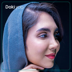 نمونه عمل بینی دکتر سولماز قربانی، جراح بینی در شیراز