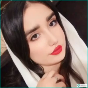 نمونه جراحی زیبایی بینی طبیعی دکتر حسین کرم نژاد در شیراز