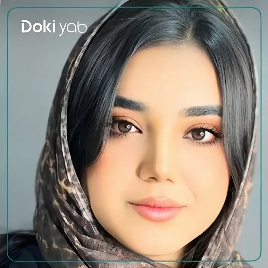 نتیجه جراحی بینی خانم با فرم نیمه فانتزی و تناسب با اجزای صورت