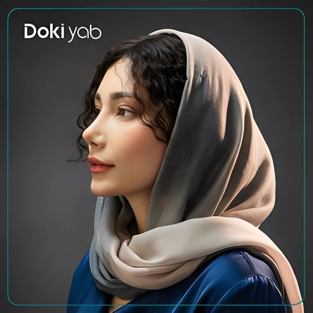 نتیجه عمل بینی نیمه فانتزی خانم با زاویه مناسب نوک بینی و قوس ظریف