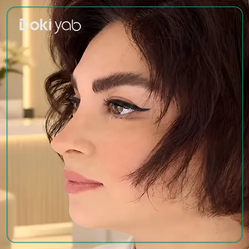 نمونه کار جراحی زیبایی بینی دکتر نرگس رزم آرا
