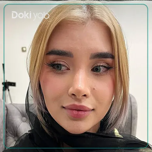 نمونه جراحی بینی با دکتر پیام حق پناه در شیراز