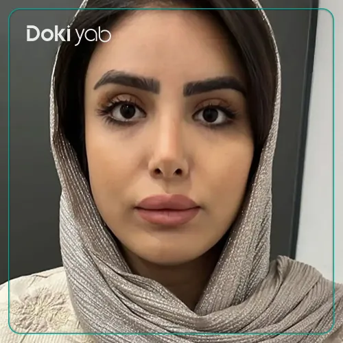 جراحی بینی با دکتر پیام حق پناه در شیراز