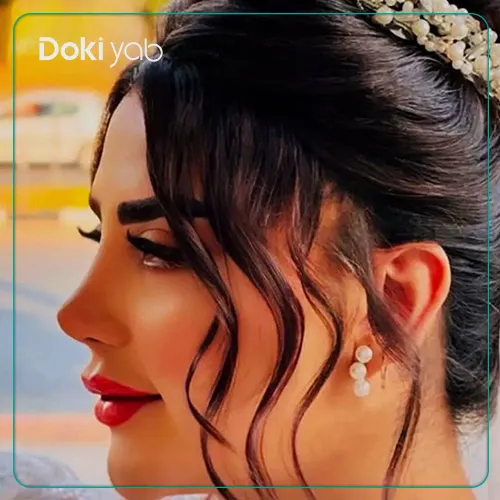 نمونه جراحی بینی با دکتر سلمان شاکری در شیراز