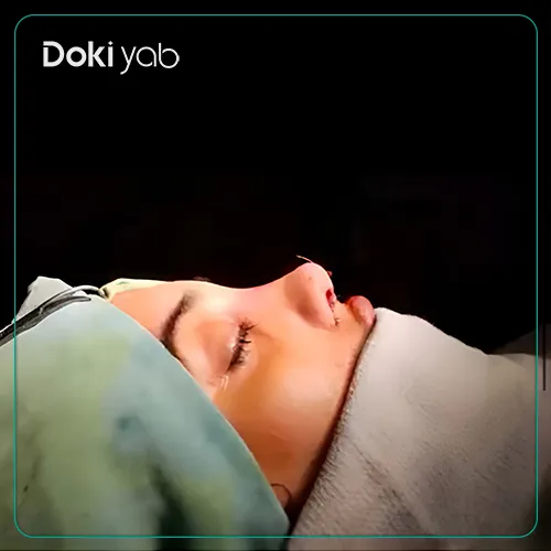 نمونه کار عمل زیبایی بینی فانتزی دکتر ونون آصفی