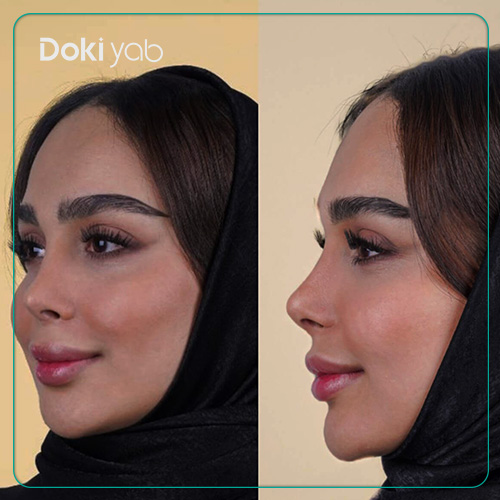 عکس دماغ فانتزی عمل شده با دکی یاب