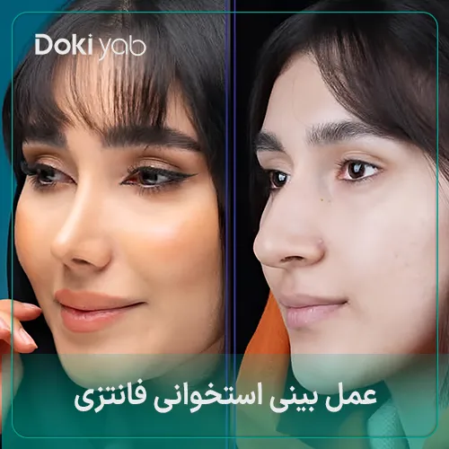 عمل بینی استخوانی فانتزی