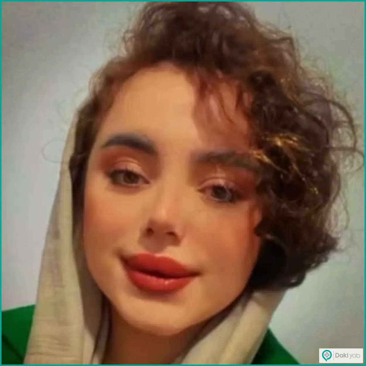 نمونه عمل زیبایی بینی نیمه فانتزی دکتر خسرو خسروی جراح بینی شیراز