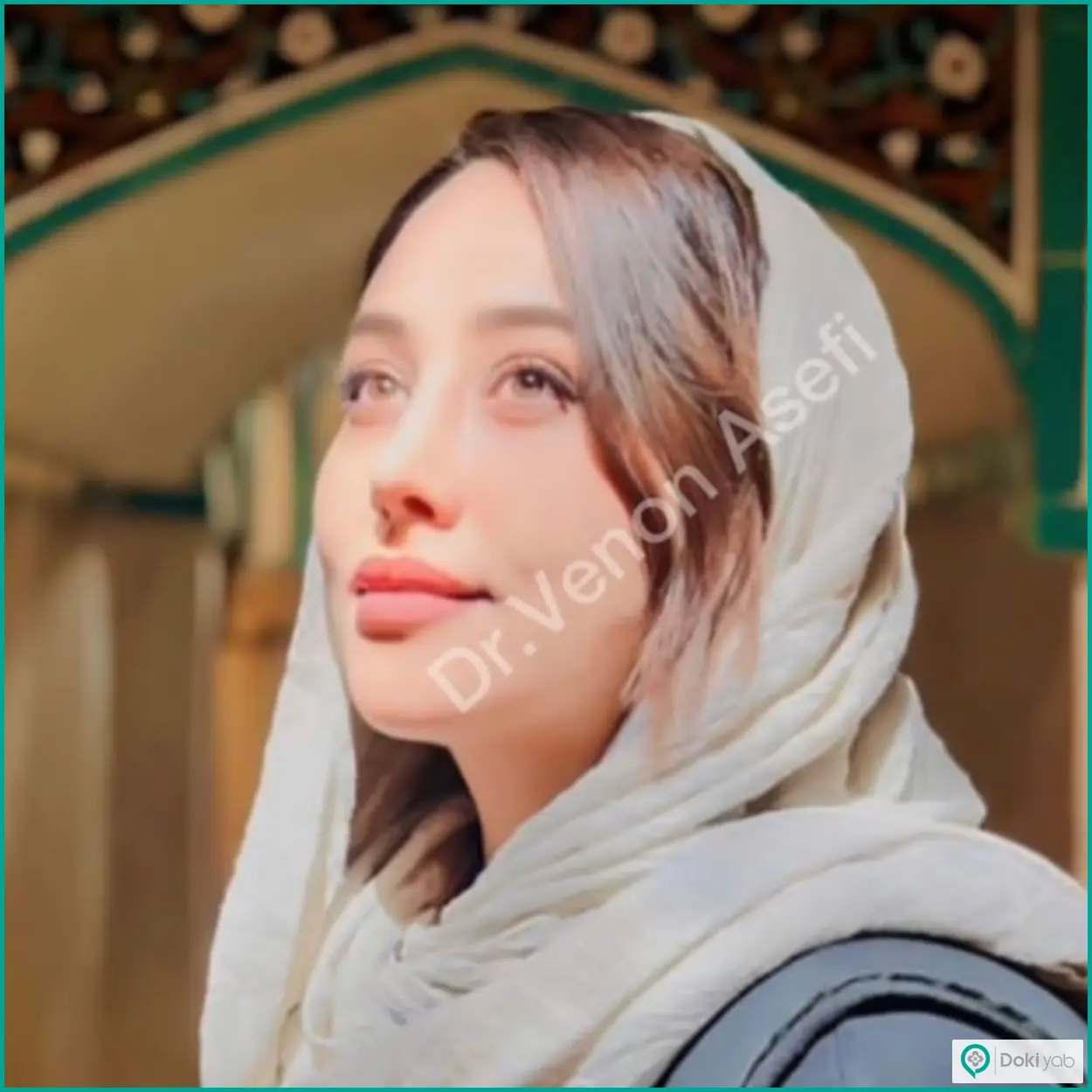 نمونه عمل بینی نیمه فانتزی دکتر ونون آصفی در شیراز