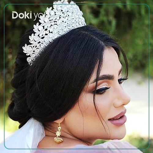 جراحی بینی به سبک نیمه فانتزی در شیراز نمونه کار دکتر ونون آصفی