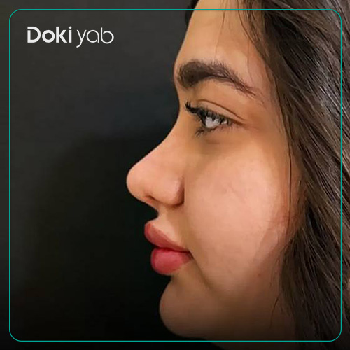 جراحی بینی دکتر زهرا خسروی به سبک طبیعی