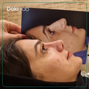 جراحی بینی طبیعی در شیراز توسط دکتر آزاده مرادی
