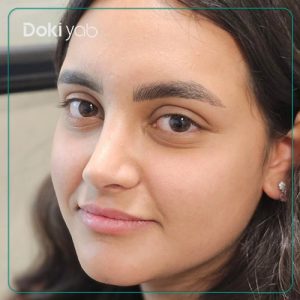 جراحی بینی طبیعی در شیراز توسط دکتر امیر خسرو برخورداری