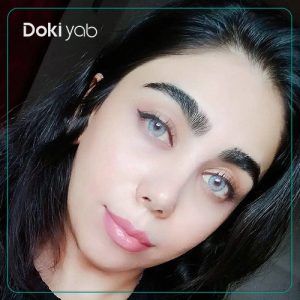 جراحی بینی فانتزی توسط دکتر غلامرضا معین در شیراز