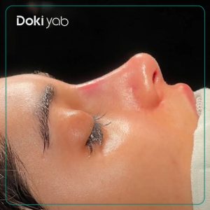 جراحی بینی نیمه فانتزی دخترانه توسط دکتر علیرضا مصباحی