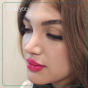 جراحی بینی نیمه فانتزی در شیراز توسط دکتر امیر خسرو برخورداری