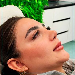 جراحی بینی نیمه فانتزی زنانه در شیراز توسط دکتر سلمان شاکری