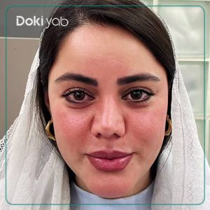 رینوپلاستی به سبک نیمه فانتزی توسط دکتر لیلا شریفی در شیراز