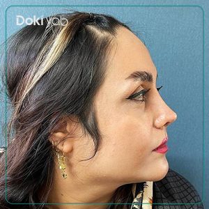 عمل بینی به سبک نیمه فانتزی توسط دکتر نگار جعفری