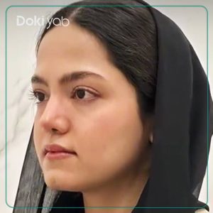 عمل بینی طبیعی در شیراز توسط دکتر مسیح طالع