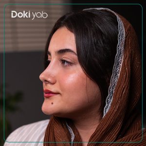 عکس نمونه کار عمل بینی دخترانه دکتر حمیدرضا کاظمی جراح بینی در شیراز