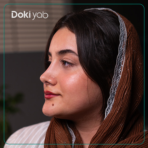 عکس نمونه کار عمل بینی دخترانه دکتر حمیدرضا کاظمی جراح بینی در شیراز