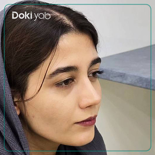 نمونه کار عمل بینی دکتر دکتر مسیح طالع به سبک طبیعی