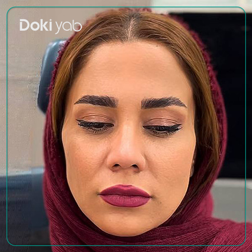 نمونه جراحی زیبایی طبیعی دکتر لیلا شریفی