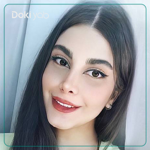 نمونه رینوپلاستی طبیعی دکتر ونون آصفی در شیراز