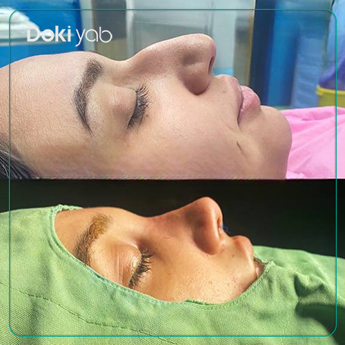 نمونه عمل بینی به سبک طبیعی دکتر زهرا خسروی