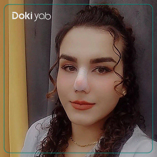 نمونه عمل بینی طبیعی دکتر غلامرضا معین