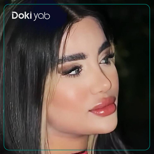 نمونه عمل بینی فانتزی دکتر زهرا خسروی