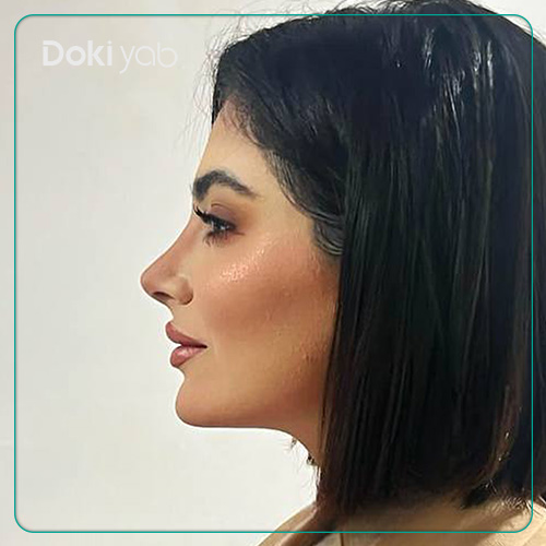 نمونه عمل بینی نیمه فانتزی توسط دکتر مجتبی قائدی در شیراز